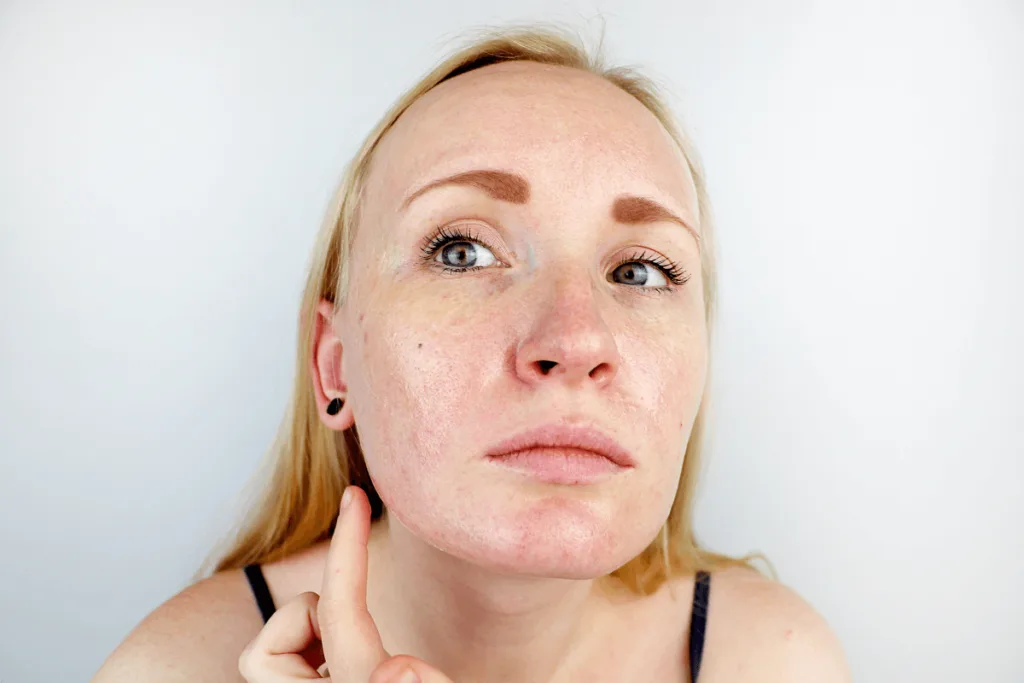 Skincare para Pele Oleosa